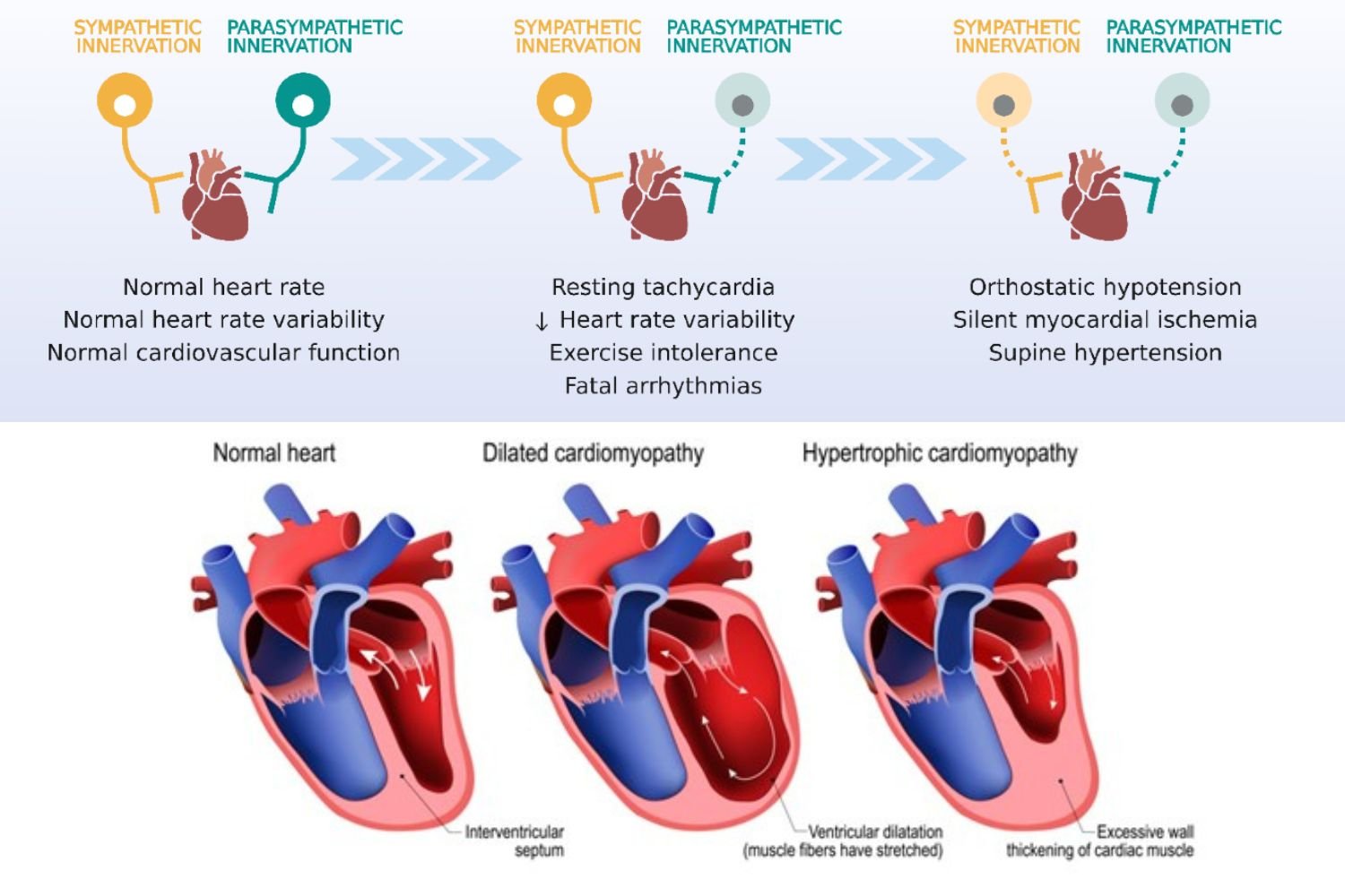 Diabetes-Heart-Disease-Myth-Busters